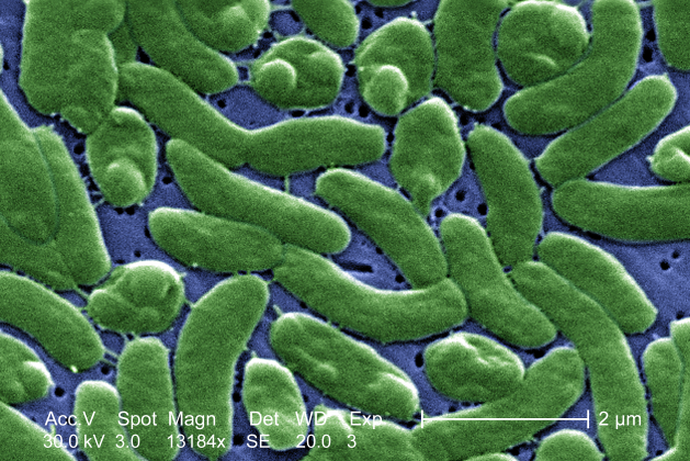 "V. vulnificus bacteria"