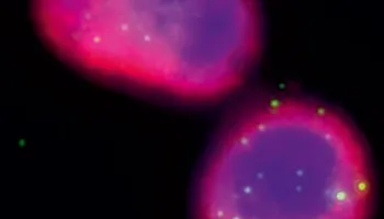 Study Advances Understanding of Immune System’s Crucial Role in Phage Therapy