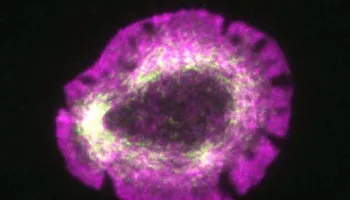 Molecular Tug-of-war Gives Cells Their Shape