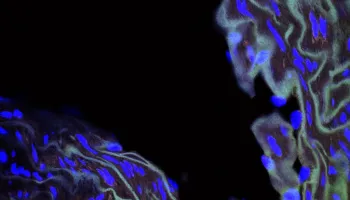 UMD-led Study Could ‘Pave the Way’ for Improved Treatment of Premature Aging Disease