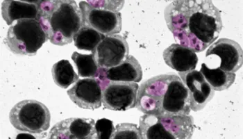 Researchers Discover Way to Predict Treatment Success for Parasitic Skin Disease