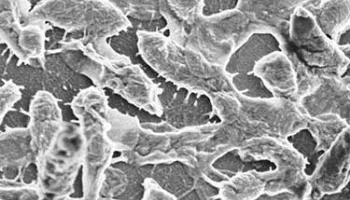 Study Reveals How Two Strains of One Bacterium Combine to Cause Flesh-eating Infection