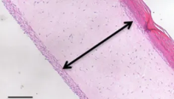 Common Antioxidant Could Slow Symptoms of Aging in Human Skin