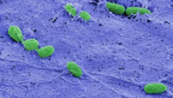 UMD-led Study Identifies the Off Switch for Biofilm Formation