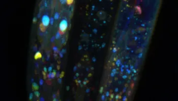 Scientists Discover Hidden Differences May Help Cells Evade Drug Therapy