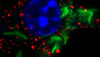 Scientists Discover a Surprising New Way that Tuberculosis Suppresses Immunity