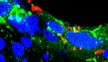 UMD Files Patents on Compounds to Treat and Prevent Gonorrhea