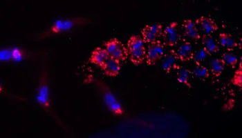 Study Finding Could Lead to Drug Therapies Against ‘Kissing Bug’ Disease