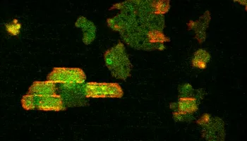 Insight into How Cells Get Signals from Physical Senses Could Lead to New Disease Treatments
