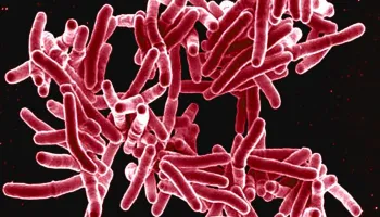 World Tuberculosis Day: Solving an Ancient Problem with New Science