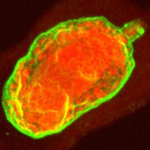 confocal image of a disease-resistant protein