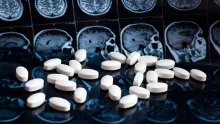 UMD researchers teamed up to explore the brain functions behind relapses in opioid use disorder, supported by a seed grant from UMD's Brain and Behavior Institute.  Photo by iStock