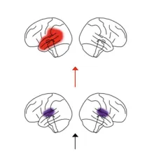 brain images