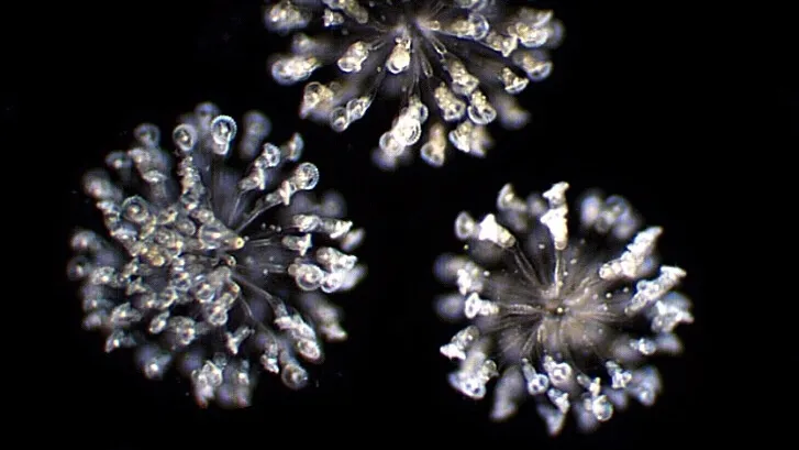 Micrograph showing three spherical, starburst-like clusters of colonial rotifers against a deep black background, with individual organisms radiating outward from central points.